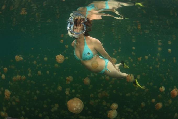 Tratamientos para la picadura de medusa